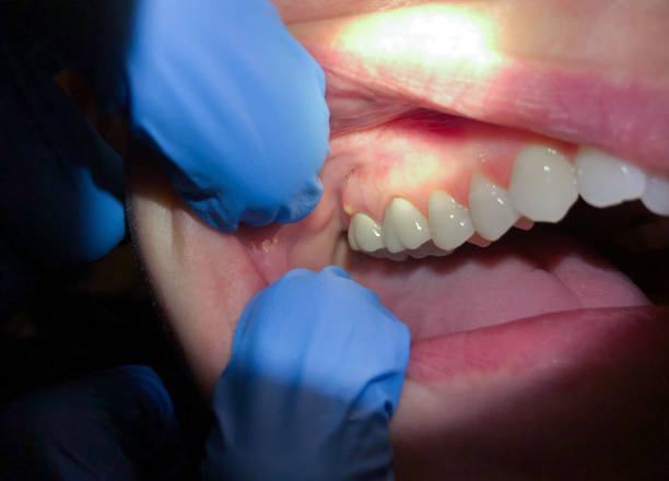 Best Emergency Cosmetic Dentistry (e.g., broken veneers) in Albemarle, NC